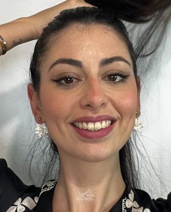 Pendientes de Biznaga Acero Dorado de artesanía Lola